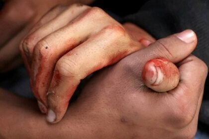 Izrael brutalno napao Gazu: “Nastavit ćemo djelovati protiv terorističkih organizacija”