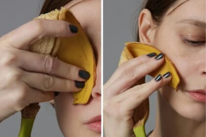 TikTok tvrdi: Piling korom od banane novi prirodni botoks
