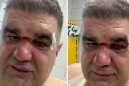 VIDEO Javio se pretučeni srpski menadžer: “Šutirao me u glavu, slomljena mi je ruka na tri mjesta…”