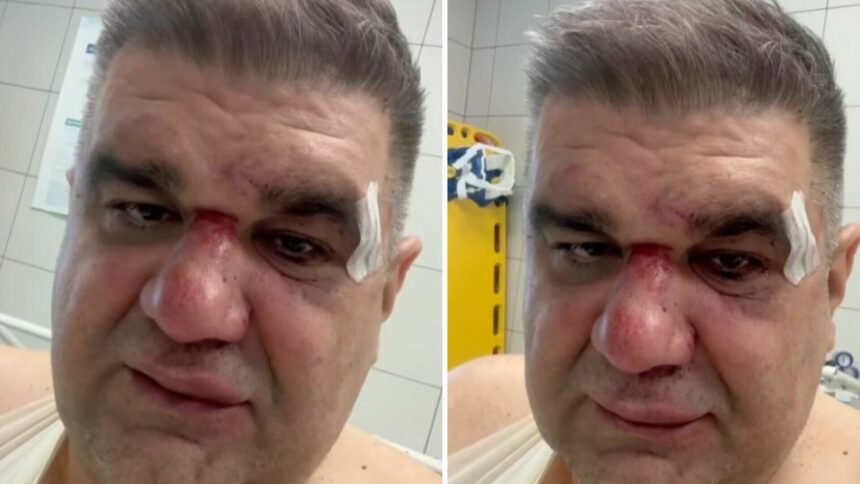 VIDEO Javio se pretučeni srpski menadžer: “Šutirao me u glavu, slomljena mi je ruka na tri mjesta…”
