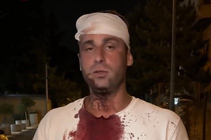 Oglasio se pretučeni zastupnik: “Kad vlast angažuje SNS huligane da brutalno tuku građane, to je slom države”