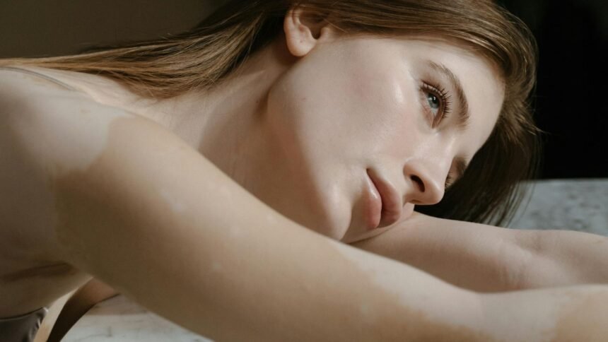 Promene na koži koje ne dovodimo u vezu sa dijabetesom, a upravo ih on izaziva