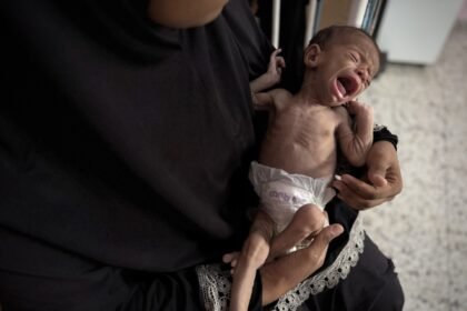 Palestinski novorođenčad gladujući u Gazi kao što se ponestaje dojenčad formula