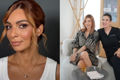 Lično iskustvo sa najtraženijim anti-age tretmanom: Šta zaista možete da očekujete od polinukleotida