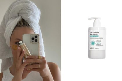 Masna koža zimi zaslužuje posebnu negu – prikupili smo najbolje savete!