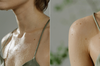 Prekomjerno znojenje je vaša svakodnevna rutina? Možda je ovo stanje uzrok