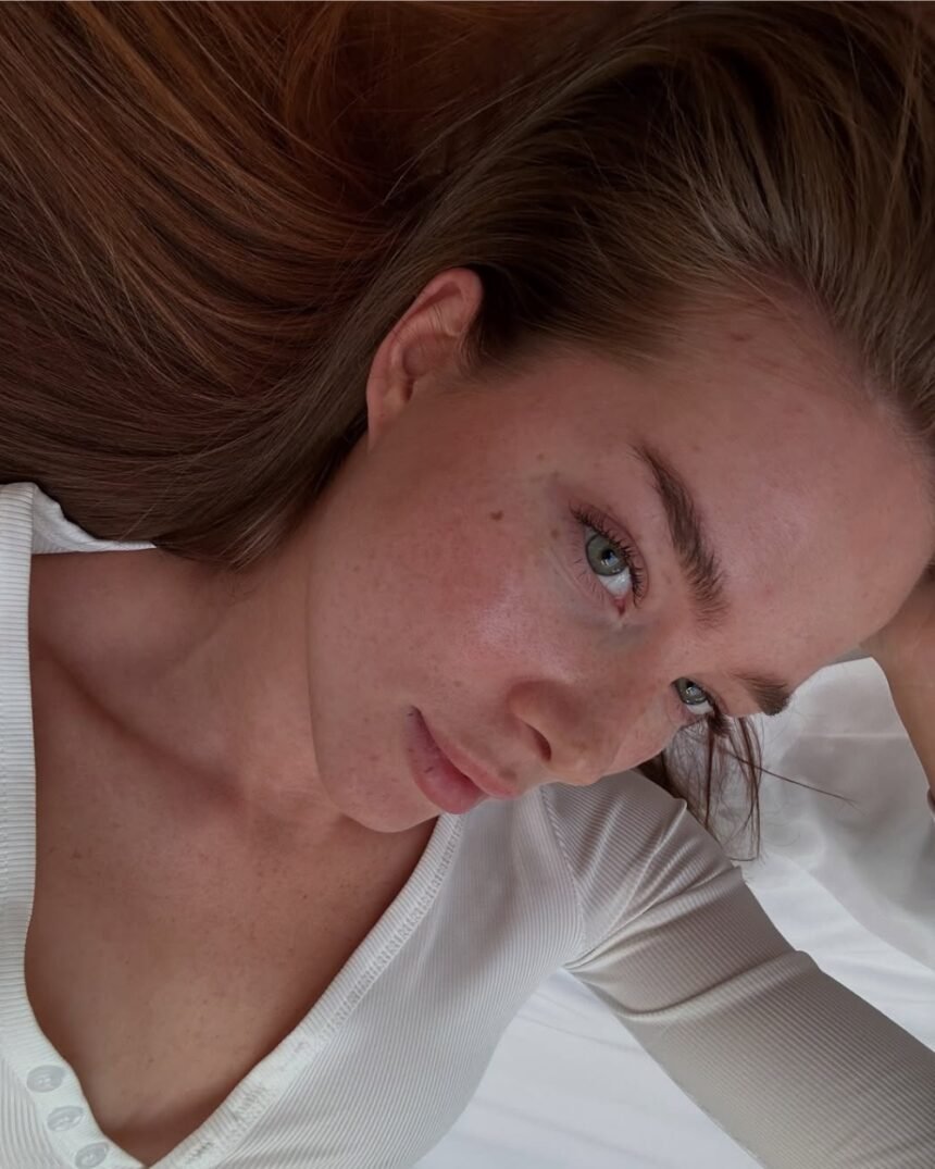 Zimska rutina: Ove kiseline za lice izbegavamo tokom hladnijih meseci