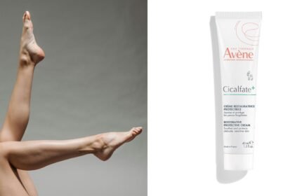 Gljivice na nogama: Kako ih držati pod kontrolom zimi?